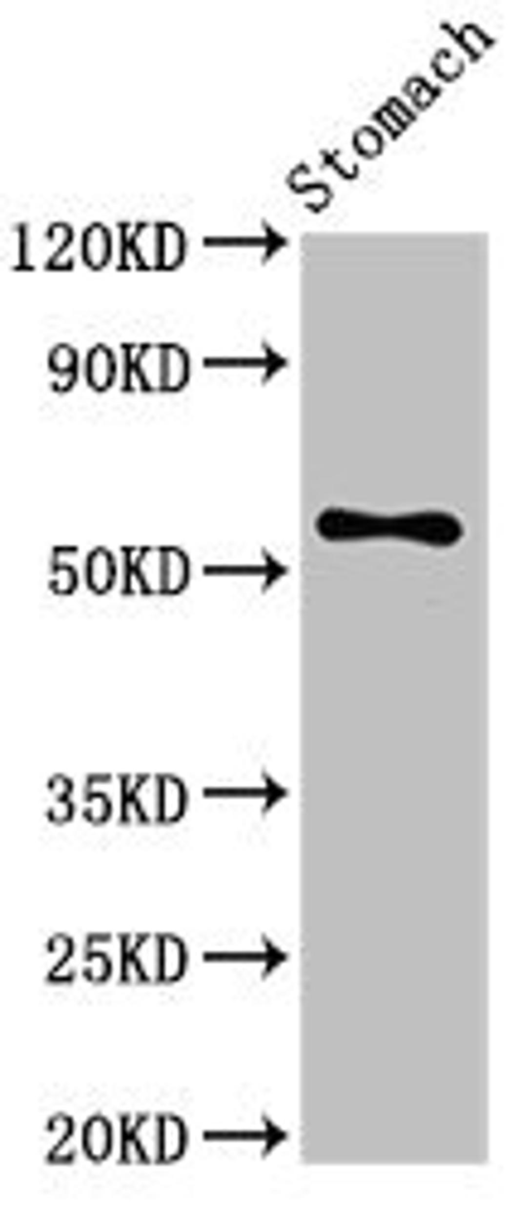 Western Blot. Positive WB detected in: Mouse stomach tissue. All lanes: SMARCD3 antibody at 3.4ug/ml. Secondary. Goat polyclonal to rabbit IgG at 1/50000 dilution. Predicted band size: 56, 54 kDa. Observed band size: 56 kDa.