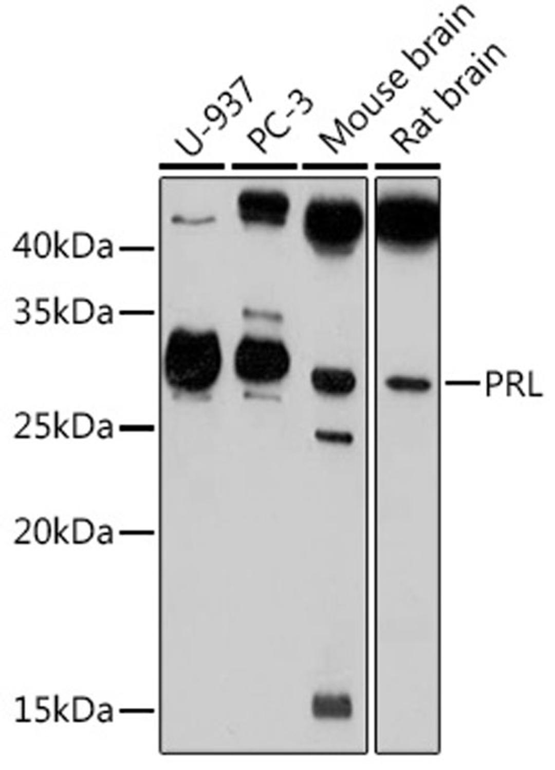 Western blot - PRL antibody (A1618)