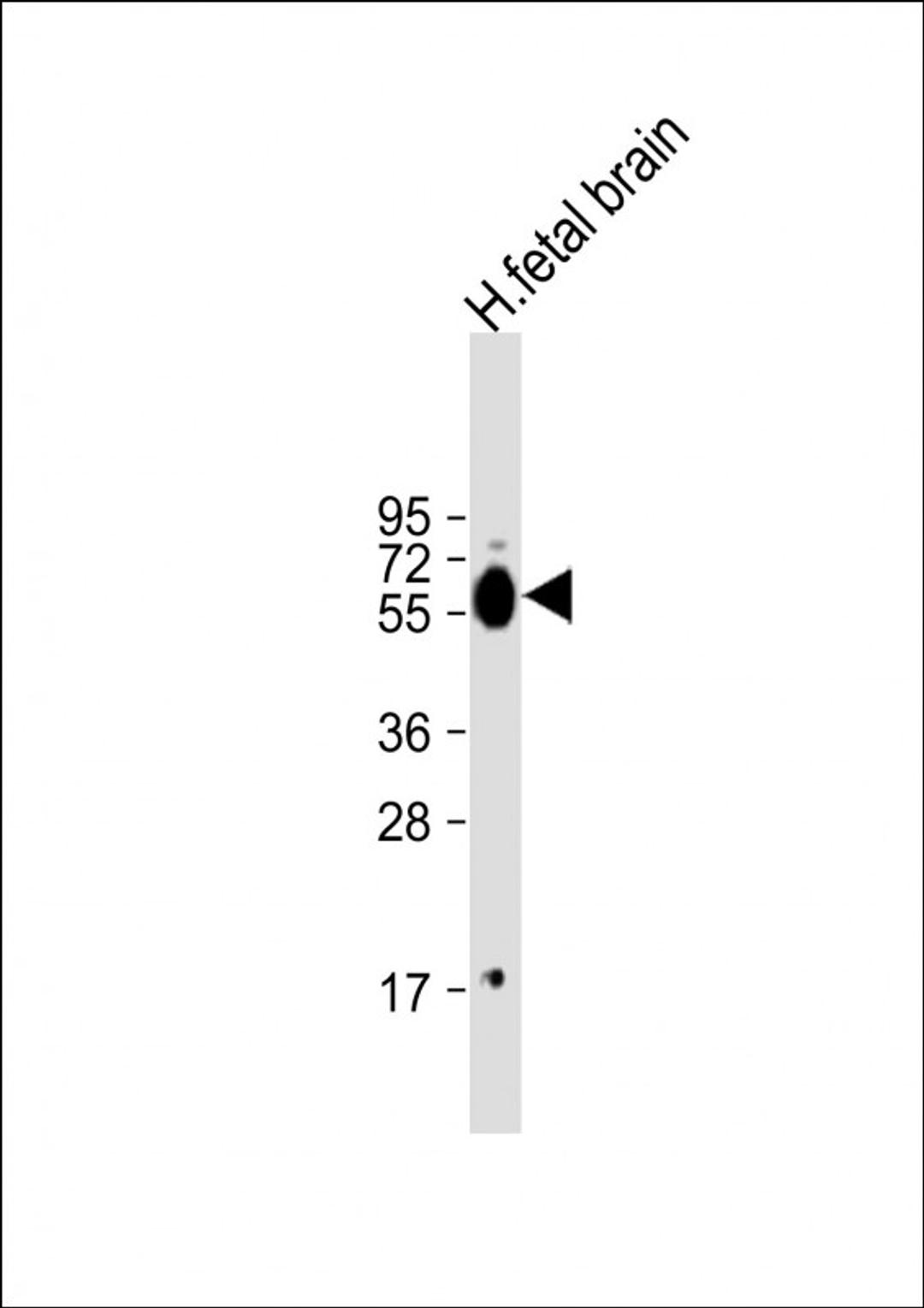 Western Blot at 1:1000 dilution + human fetal brain lysate Lysates/proteins at 20 ug per lane.