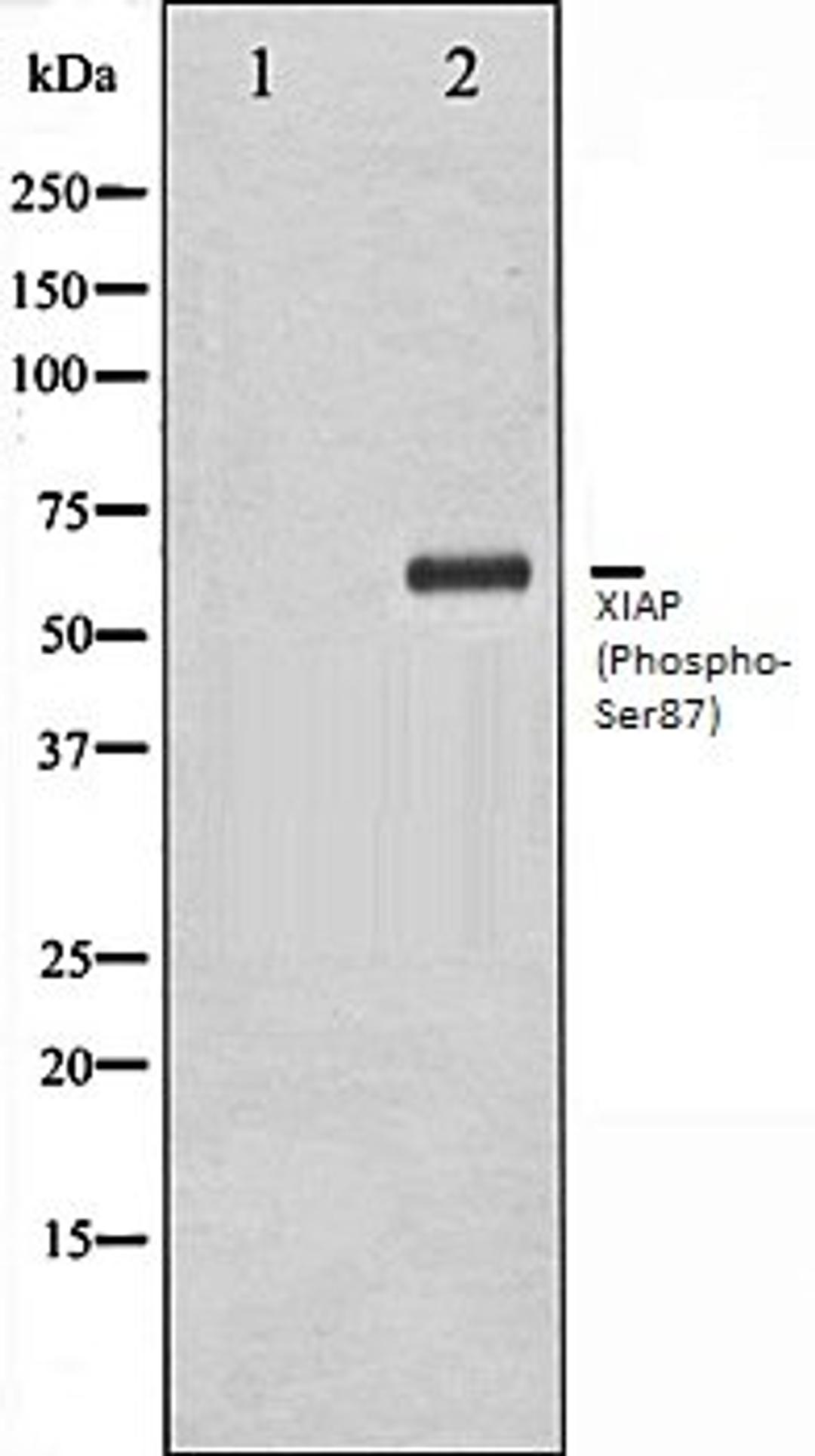 Western blot analysis of HepG2 whole cell lysates using XIAP (Phospho-Ser87) antibody, The lane on the left is treated with the antigen-specific peptide.