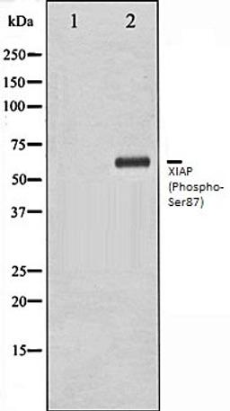 Western blot analysis of HepG2 whole cell lysates using XIAP (Phospho-Ser87) antibody, The lane on the left is treated with the antigen-specific peptide.