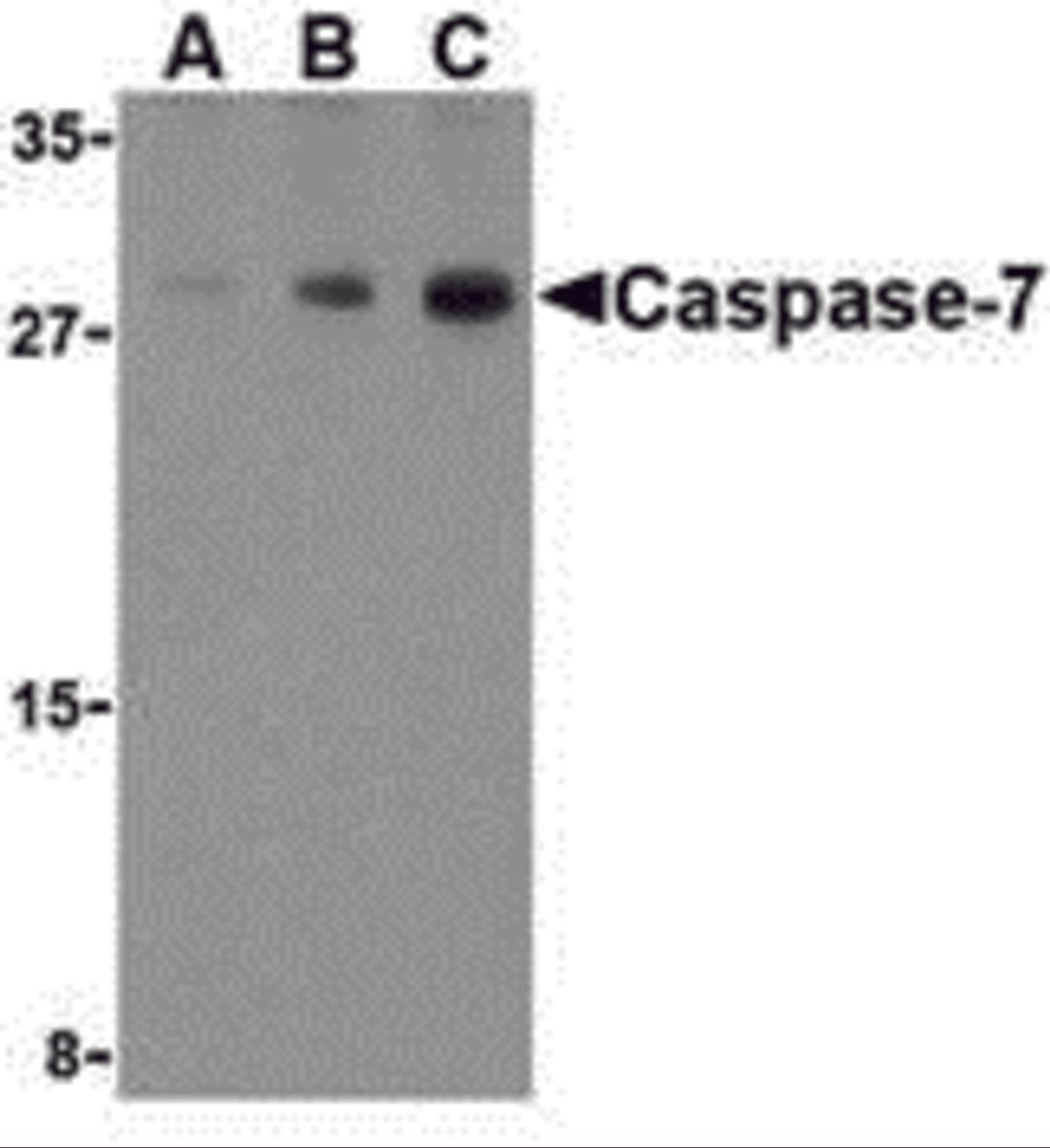 Western blot analysis of Caspase-7 in human skeletal muscle cell lysate with Caspase-7 antibody at (A) 0.5, (B) 1, and (C) 2 μg/mL.