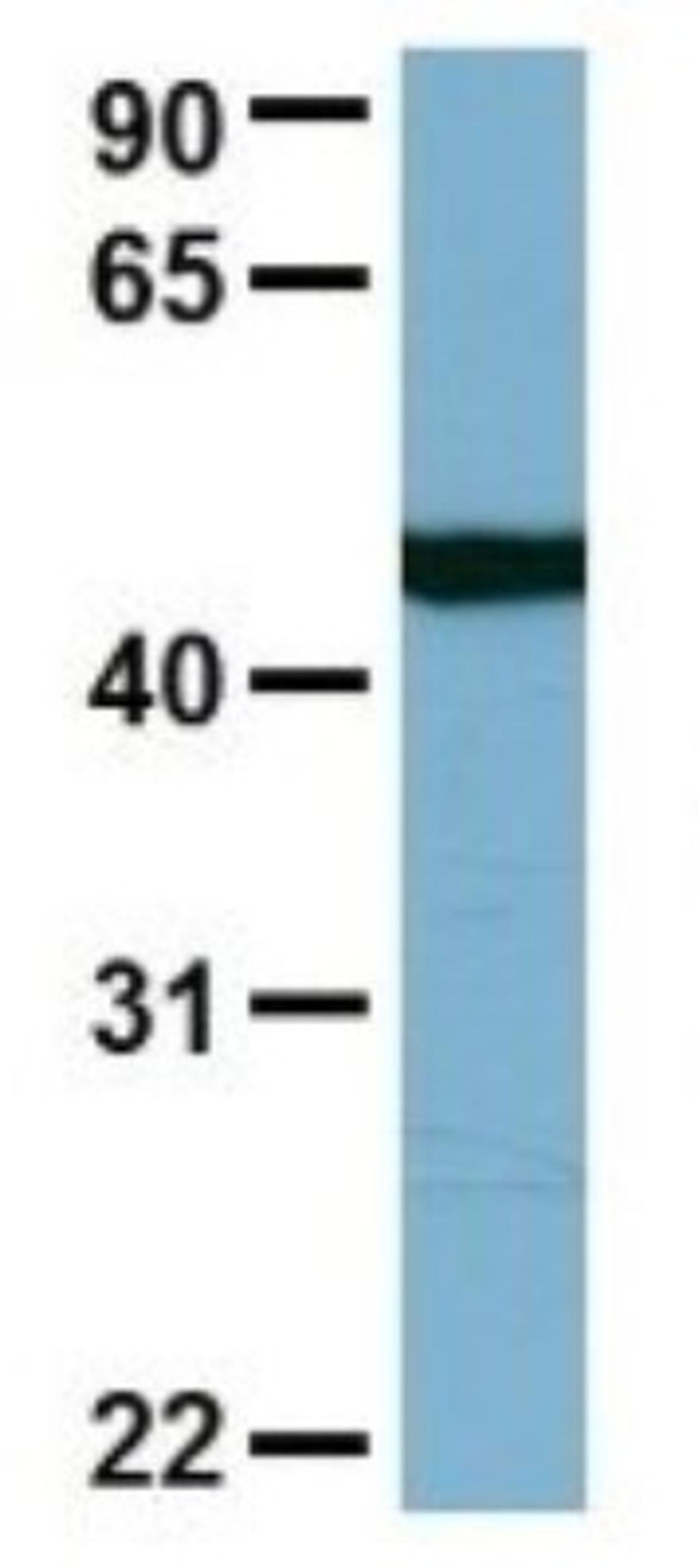 Western Blot: FAAP Antibody [NBP1-56855] - Jurkat, Antibody Dilution: 1.0 ug/ml RTCB is supported by BioGPS gene expression data to be expressed in Jurkat.