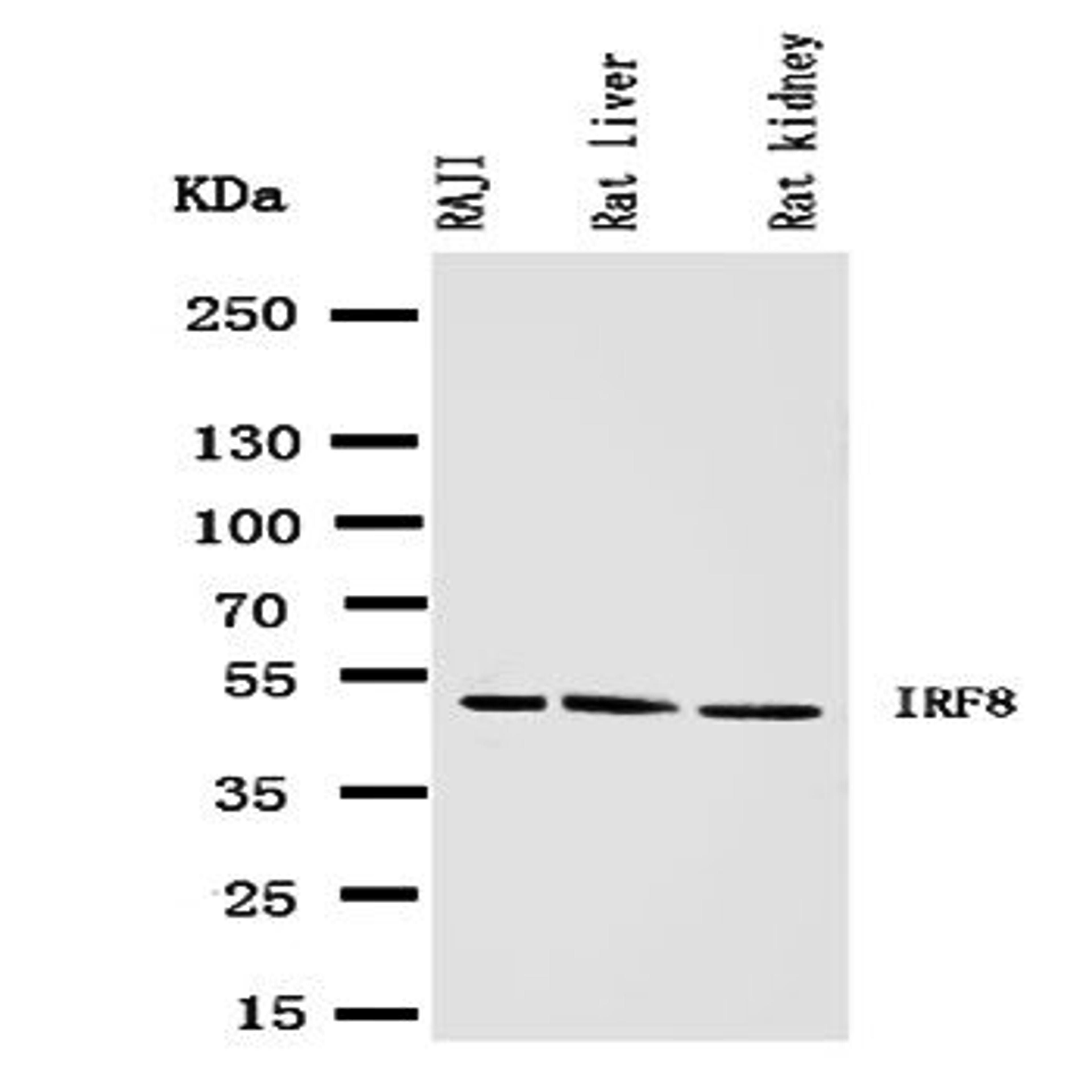 Western blot analysis of Lane 1: RAJI Cell Lysate, Lane 2: Rat Liver Tissue Lysate, Lane 3: Rat Kidney Tissue Lysate using IRF8 antibody