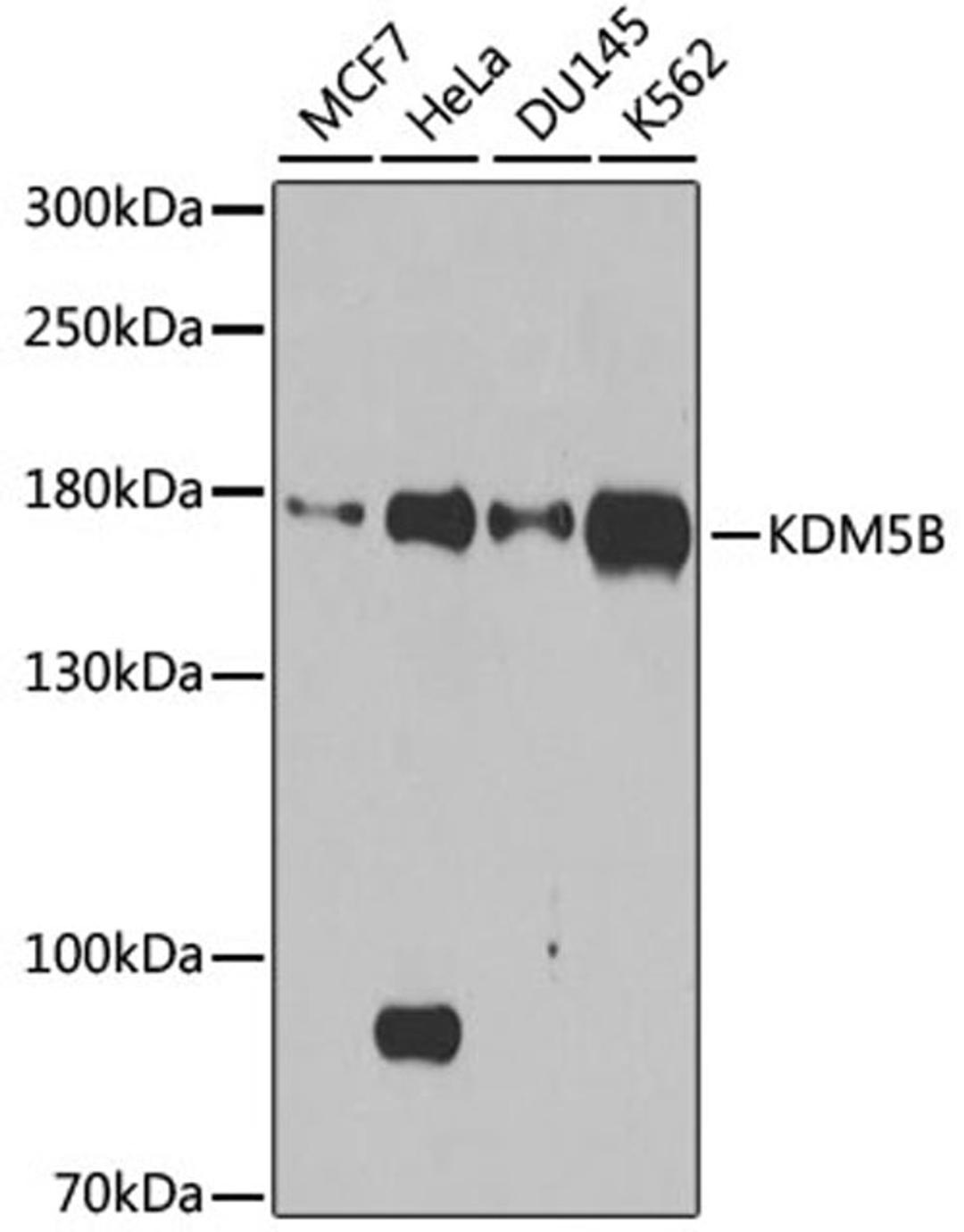 Western blot - KDM5B antibody (A7772)