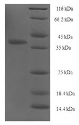 (Tris-Glycine gel) Discontinuous SDS-PAGE (reduced) with 5% enrichment gel and 15% separation gel.