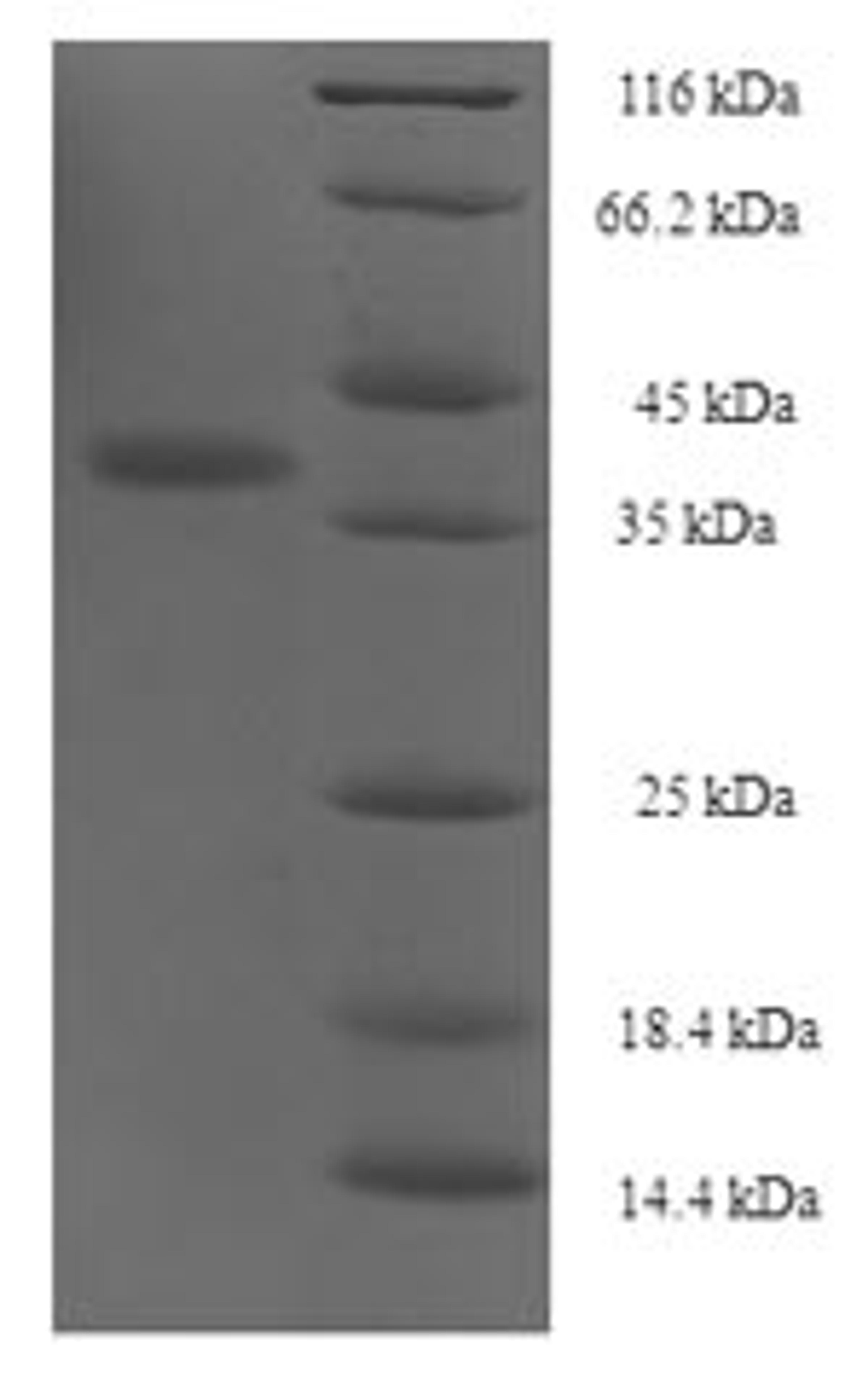 (Tris-Glycine gel) Discontinuous SDS-PAGE (reduced) with 5% enrichment gel and 15% separation gel.