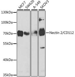 Western blot - Nectin 2/CD112 antibody (A5378)