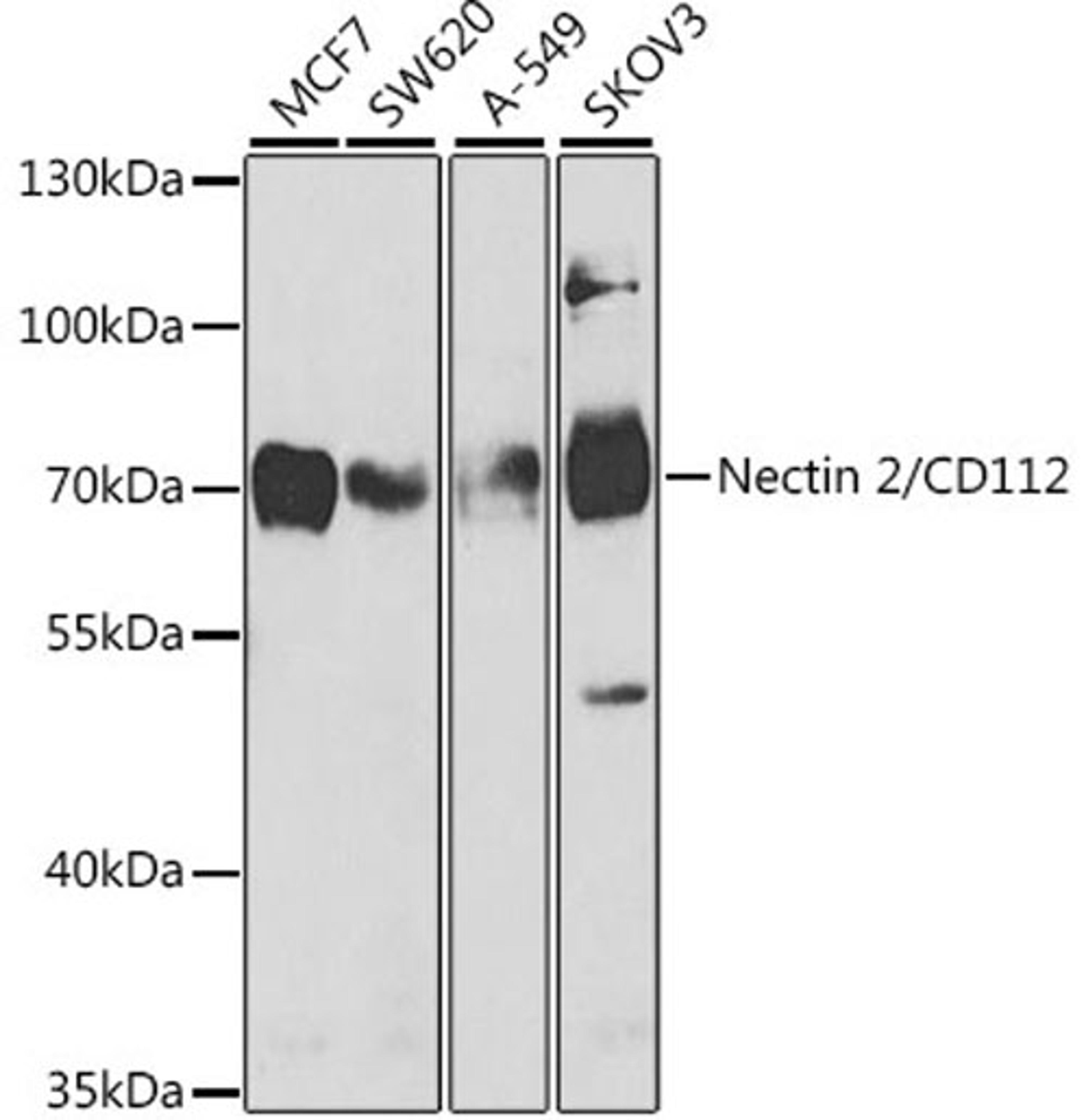 Western blot - Nectin 2/CD112 antibody (A5378)