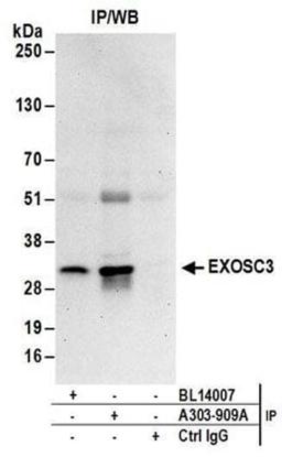 Detection of human EXOSC3 by western blot of immunoprecipitates.