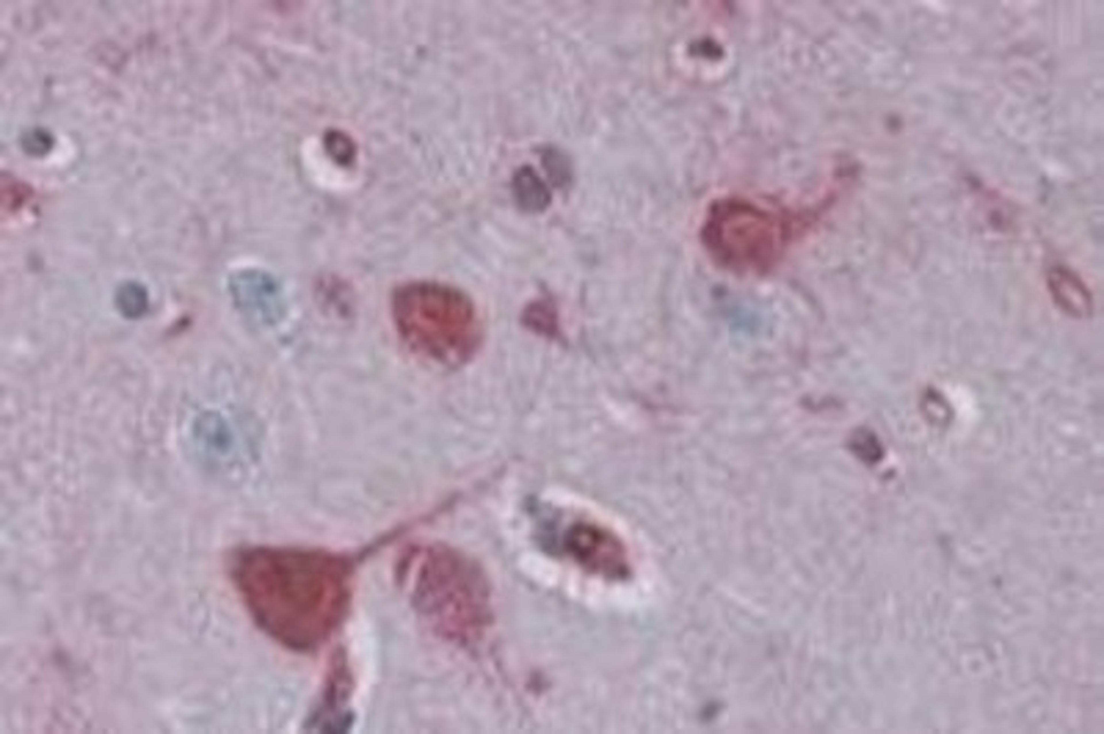 Immunohistochemistry-Paraffin: RAE1 Antibody [NB100-1894] - staining.