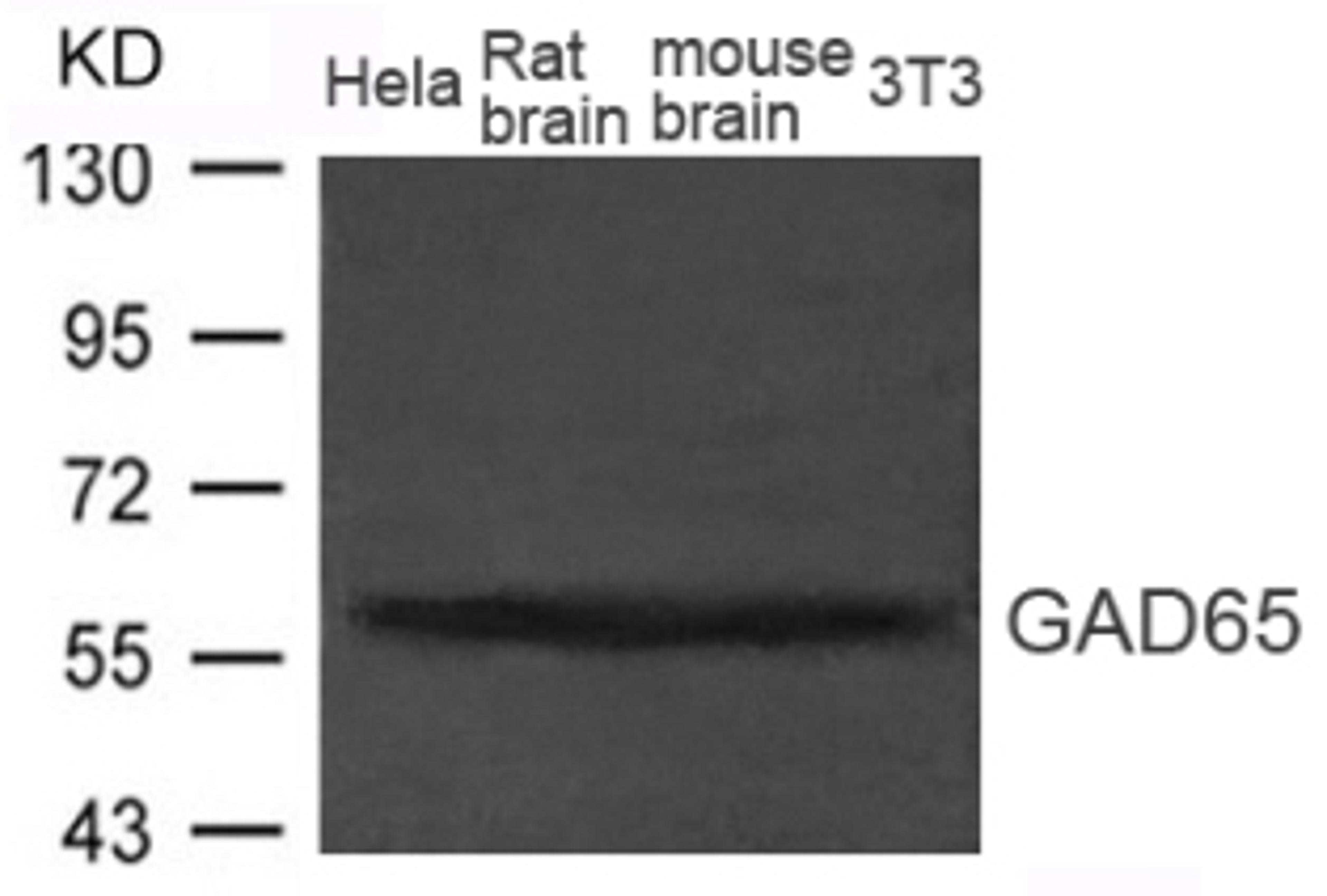 Western blot analysis of extract from Rat brain, Mouse brain tissue and HeLa, 3T3 cells using GAD65 (GAD2)).