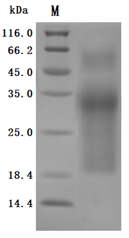 (Tris-Glycine gel) Discontinuous SDS-PAGE (reduced) with 5% enrichment gel and 15% separation gel.
