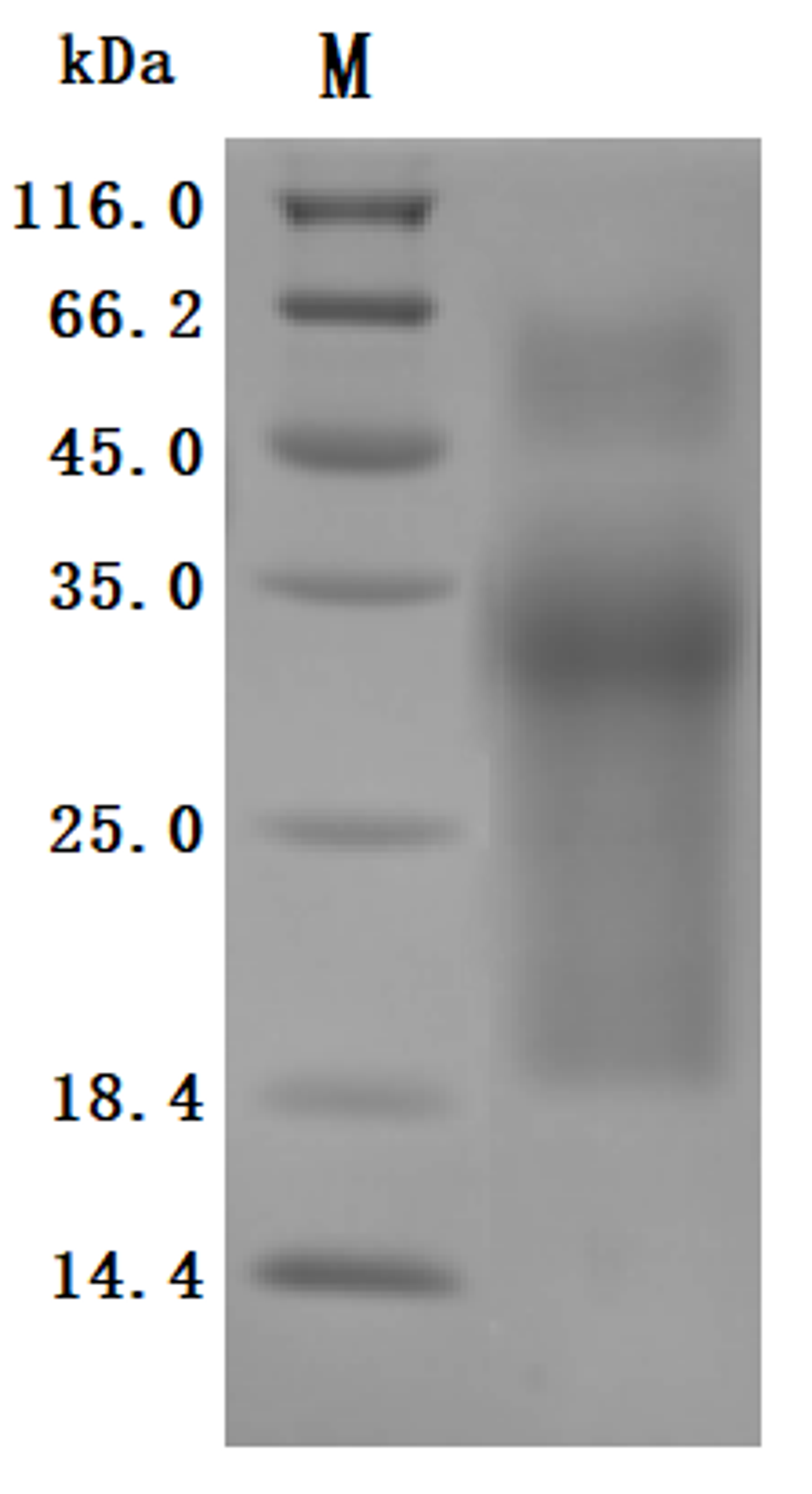 (Tris-Glycine gel) Discontinuous SDS-PAGE (reduced) with 5% enrichment gel and 15% separation gel.