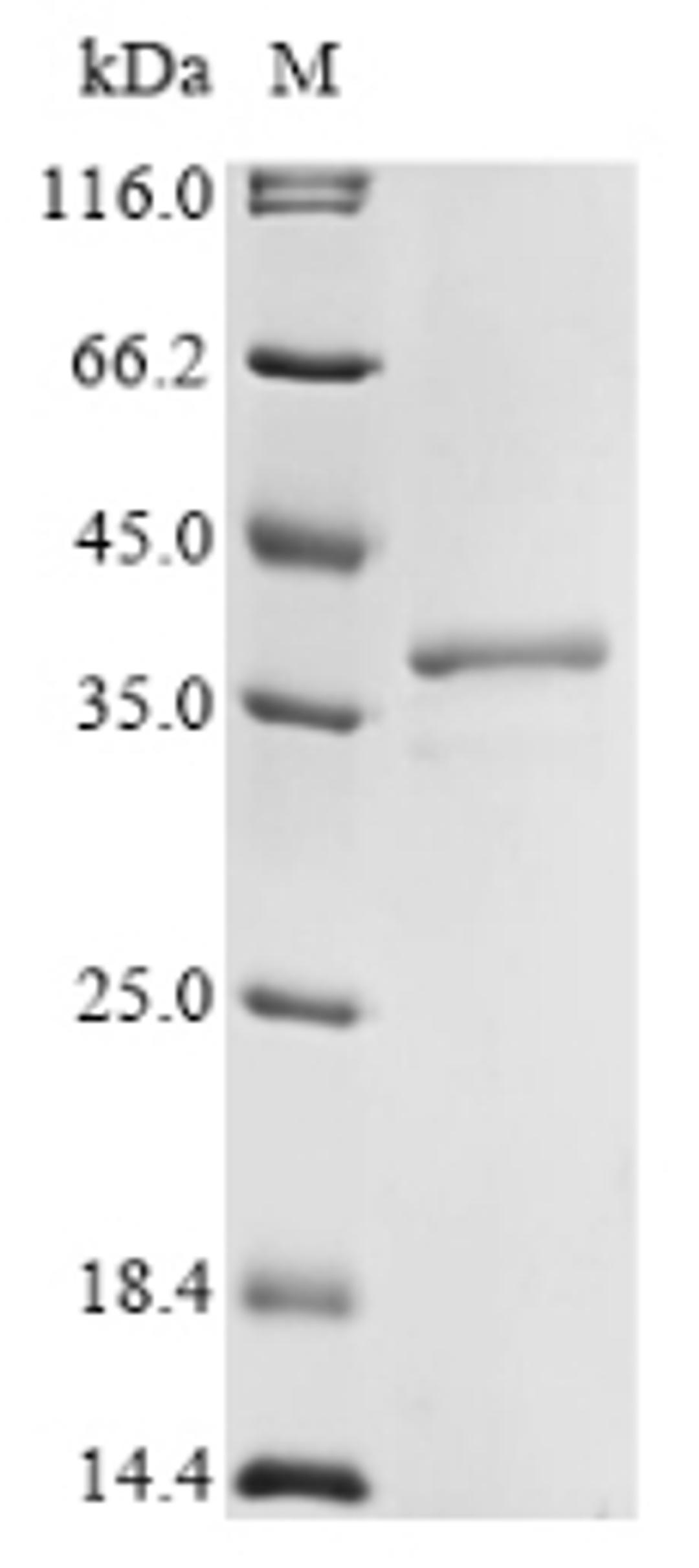 (Tris-Glycine gel) Discontinuous SDS-PAGE (reduced) with 5% enrichment gel and 15% separation gel.
