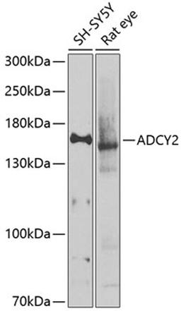 Western blot - ADCY2 antibody (A9805)