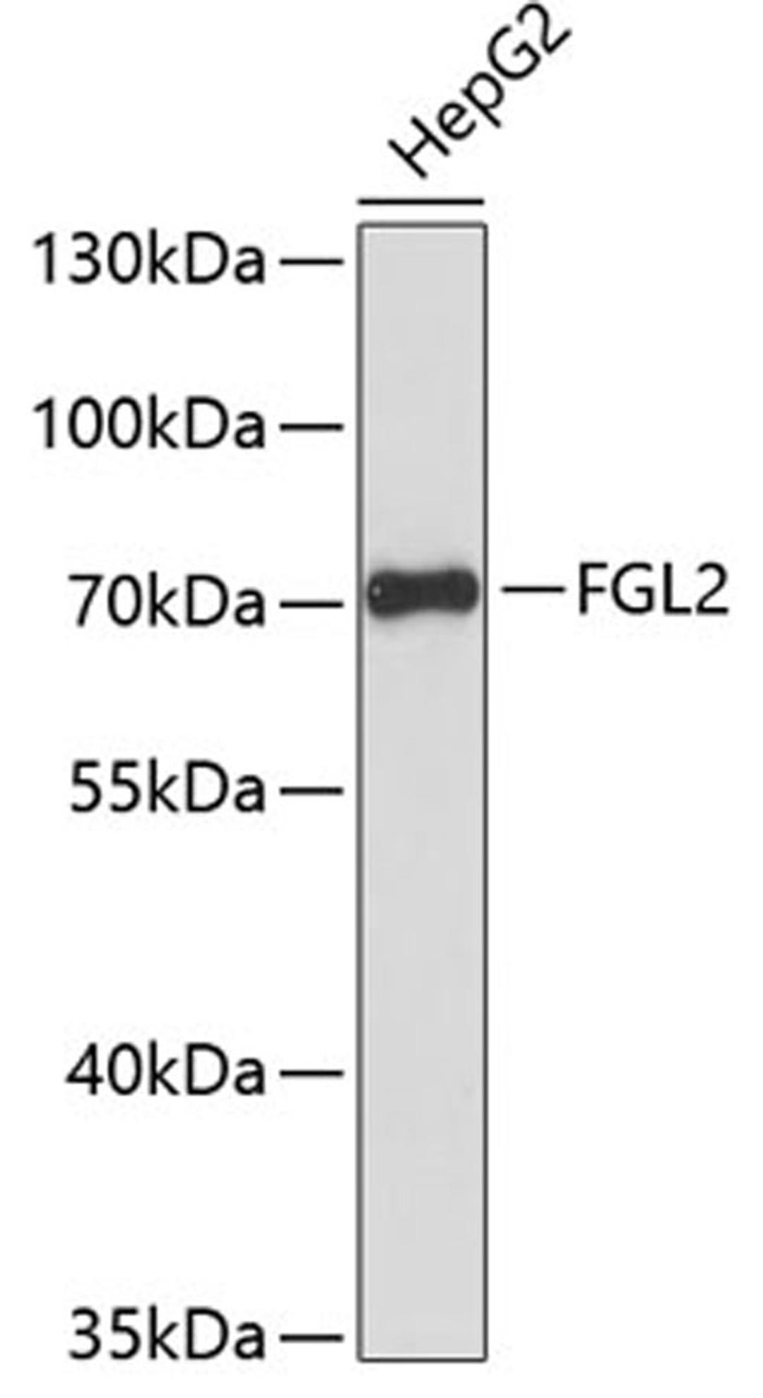 Western blot - FGL2 antibody (A13755)