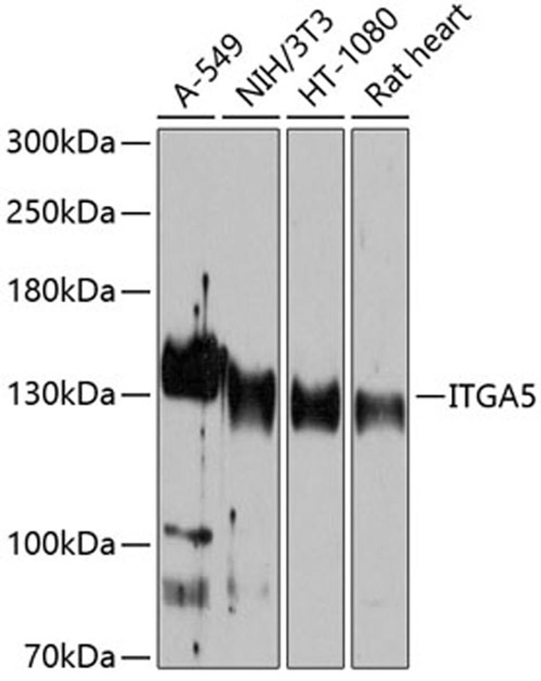 Western blot - ITGA5 antibody (A6209)