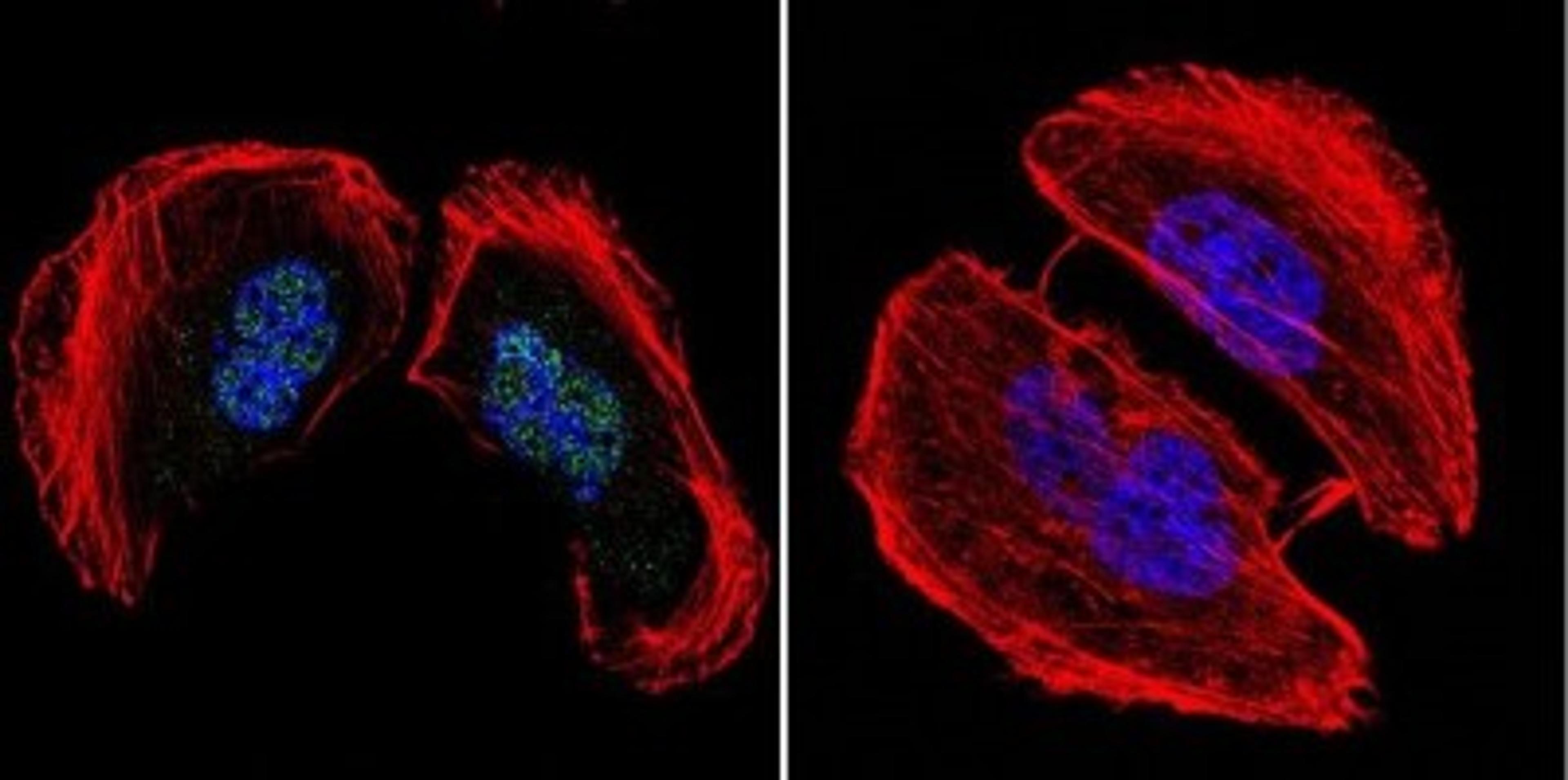 Immunocytochemistry/Immunofluorescence: AP2 alpha Antibody (3B5) [NB100-74359] - Analysis of AP2 using Anti-AP2 Monoclonal Antibody (3B5) shows staining in U251 Cells. AP2 staining (green), F-Actin staining with Phalloidin (red) and nuclei with DAPI (blue) is shown.