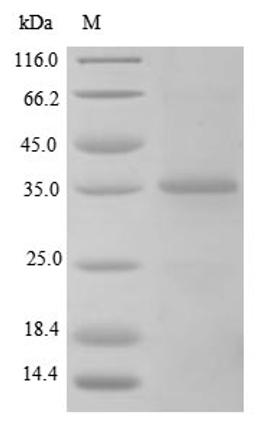 (Tris-Glycine gel) Discontinuous SDS-PAGE (reduced) with 5% enrichment gel and 15% separation gel.