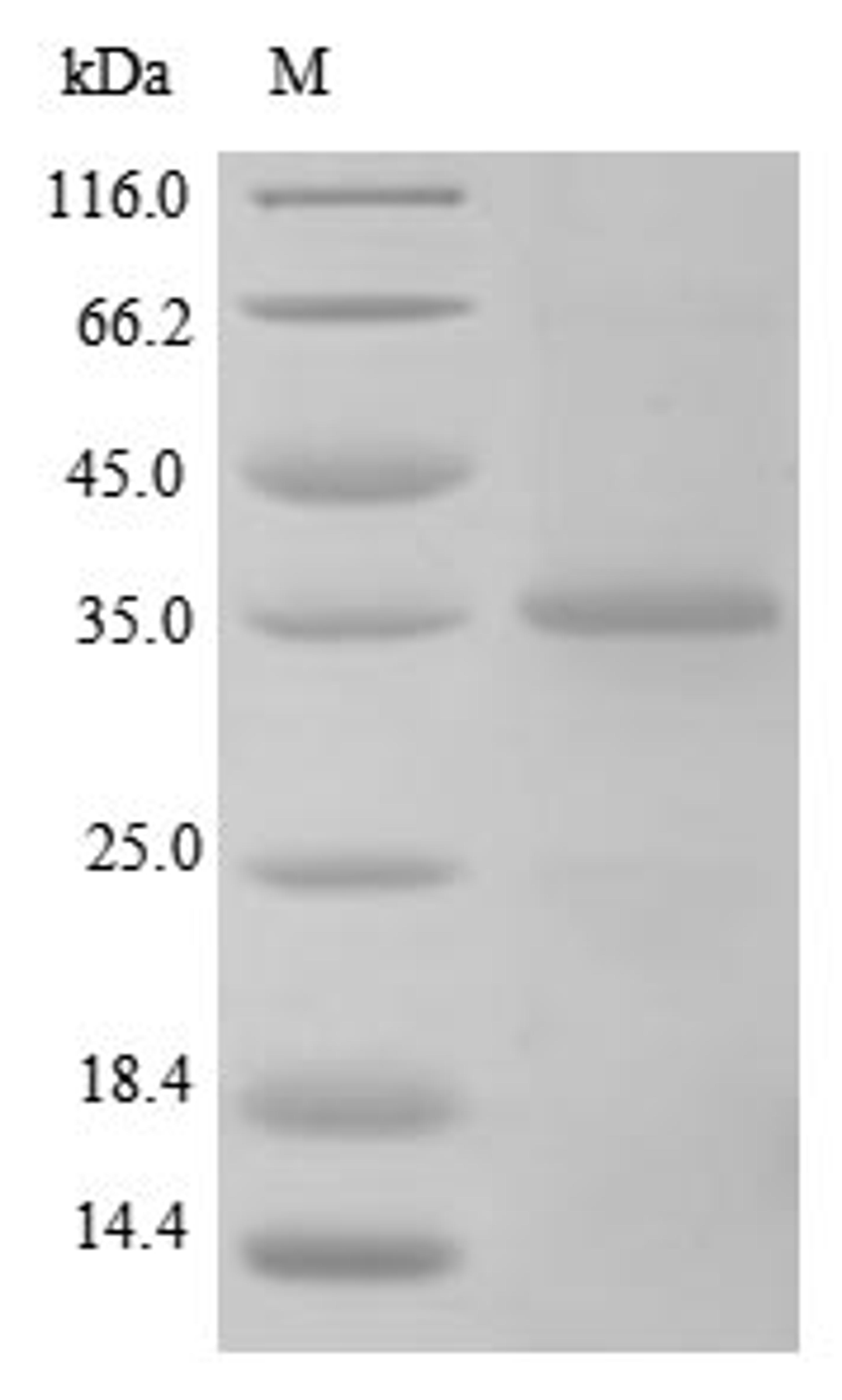 (Tris-Glycine gel) Discontinuous SDS-PAGE (reduced) with 5% enrichment gel and 15% separation gel.