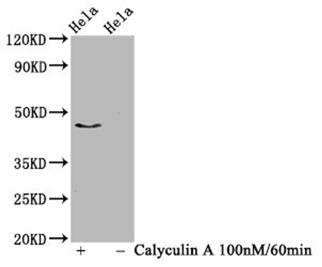 Western Blot. Positive WB detected in Hela whole cell lysate(treated with Calyculin A or not). All lanes Phospho-IRF3 antibody at 1.03μg/ml. Secondary. Goat polyclonal to rabbit IgG at 1/50000 dilution. Predicted band size: 47 KDa. Observed band size: 47 KDa.
