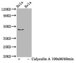 Western Blot. Positive WB detected in Hela whole cell lysate(treated with Calyculin A or not). All lanes Phospho-IRF3 antibody at 1.03μg/ml. Secondary. Goat polyclonal to rabbit IgG at 1/50000 dilution. Predicted band size: 47 KDa. Observed band size: 47 KDa.