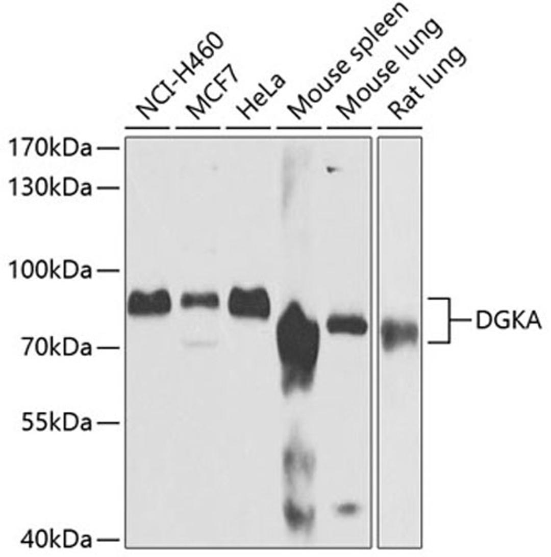 Western blot - DGKA antibody (A6896)