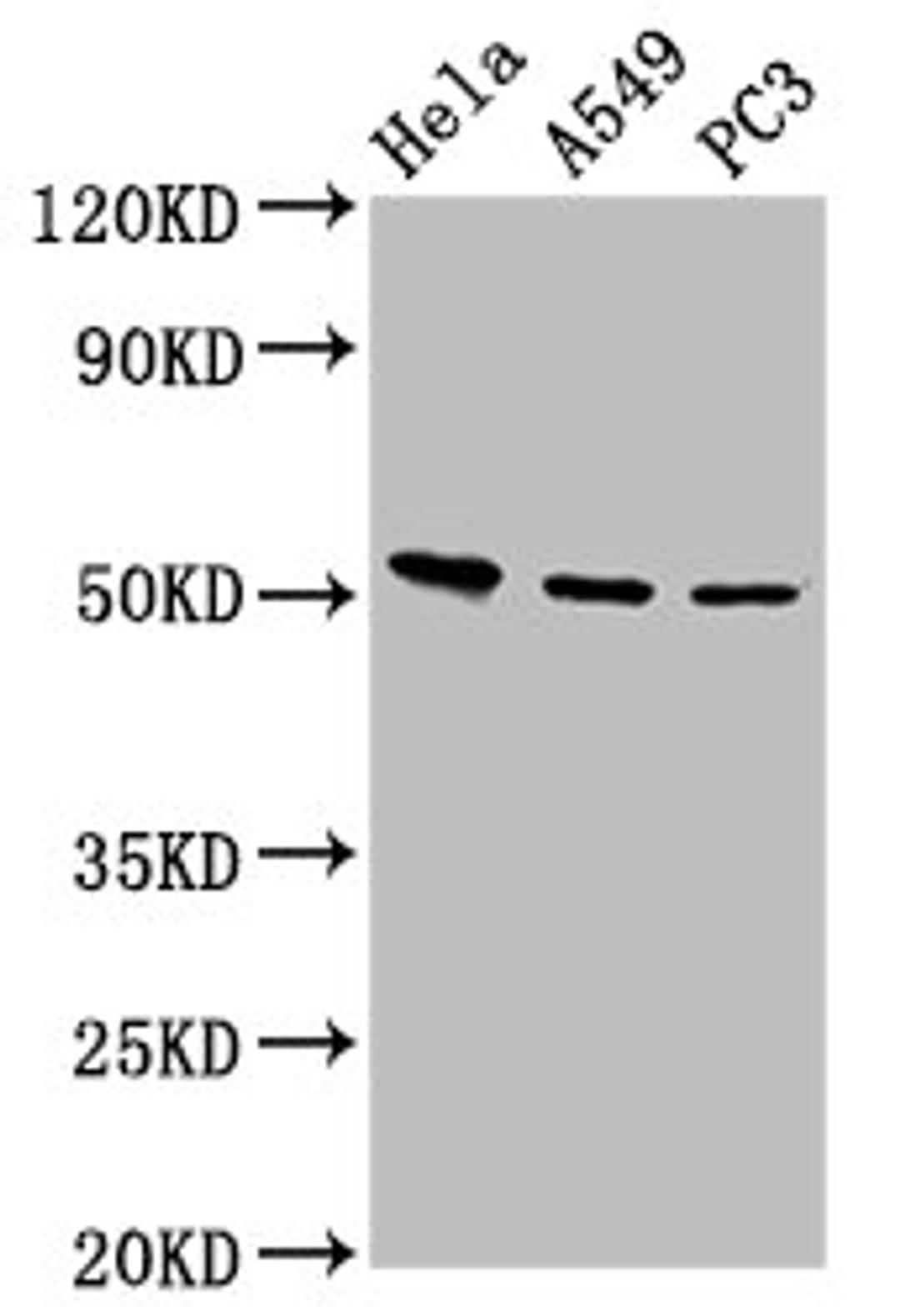 Western Blot. Positive WB detected in: Hela whole cell lysate, A549 whole cell lysate, PC-3 whole cell lysate. All lanes: ALS2CR12 antibody at 12µg/ml. Secondary. Goat polyclonal to rabbit IgG at 1/50000 dilution. Predicted band size: 53, 50 kDa. Observed band size: 53 kDa
