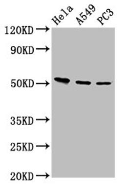 Western Blot. Positive WB detected in: Hela whole cell lysate, A549 whole cell lysate, PC-3 whole cell lysate. All lanes: ALS2CR12 antibody at 12µg/ml. Secondary. Goat polyclonal to rabbit IgG at 1/50000 dilution. Predicted band size: 53, 50 kDa. Observed band size: 53 kDa
