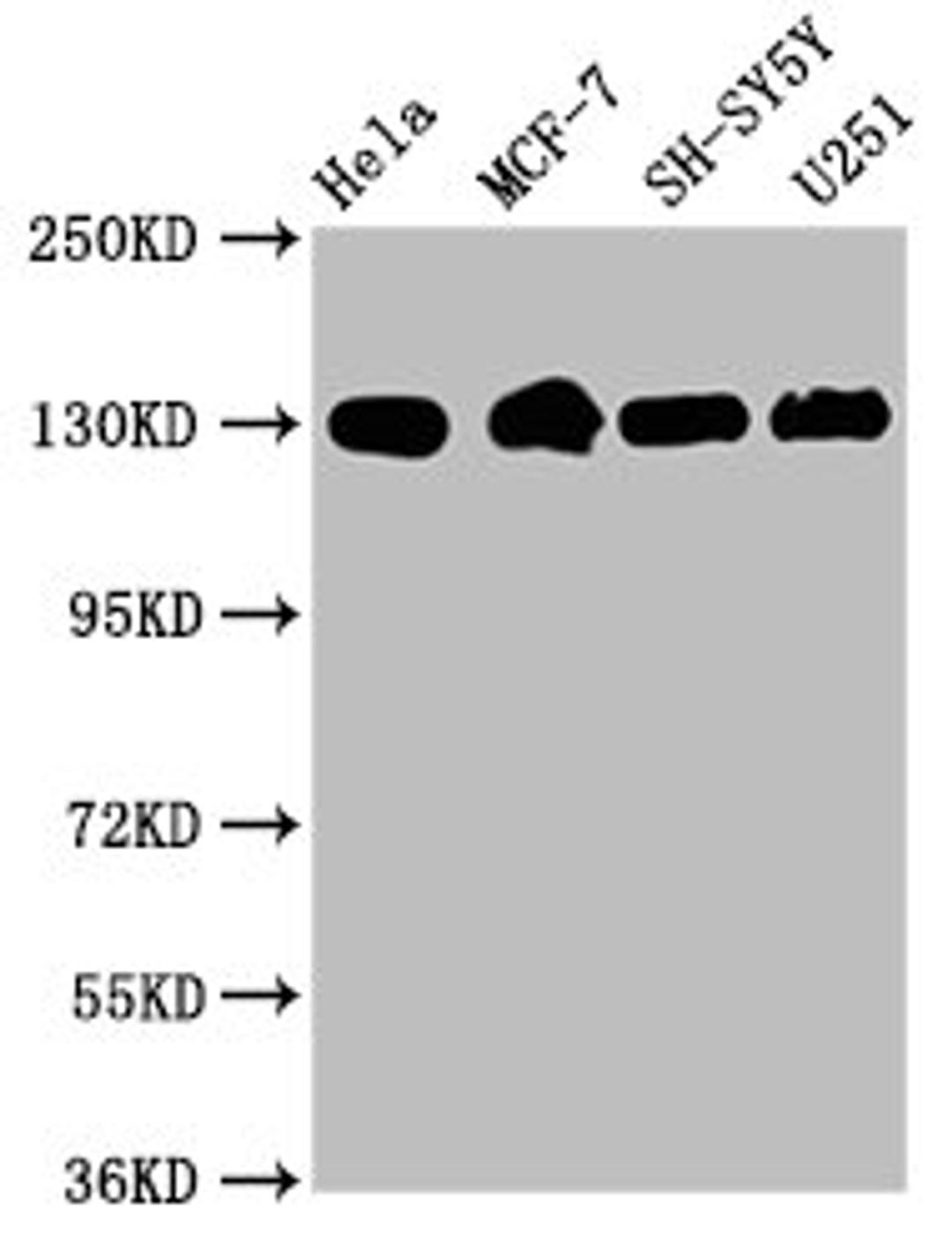 Western Blot. Positive WB detected in: Hela whole cell lysate, MCF-7 whole cell lysate, SH-SY5Y whole cell lysate, U251 whole cell lysate. All lanes: Integrin beta-1/CD29 antibody at 1.9μg/ml. Secondary. Goat polyclonal to rabbit IgG at 1/50000 dilution. Predicted band size: 89, 88, 92 KDa. Observed band size: 130 KDa. 