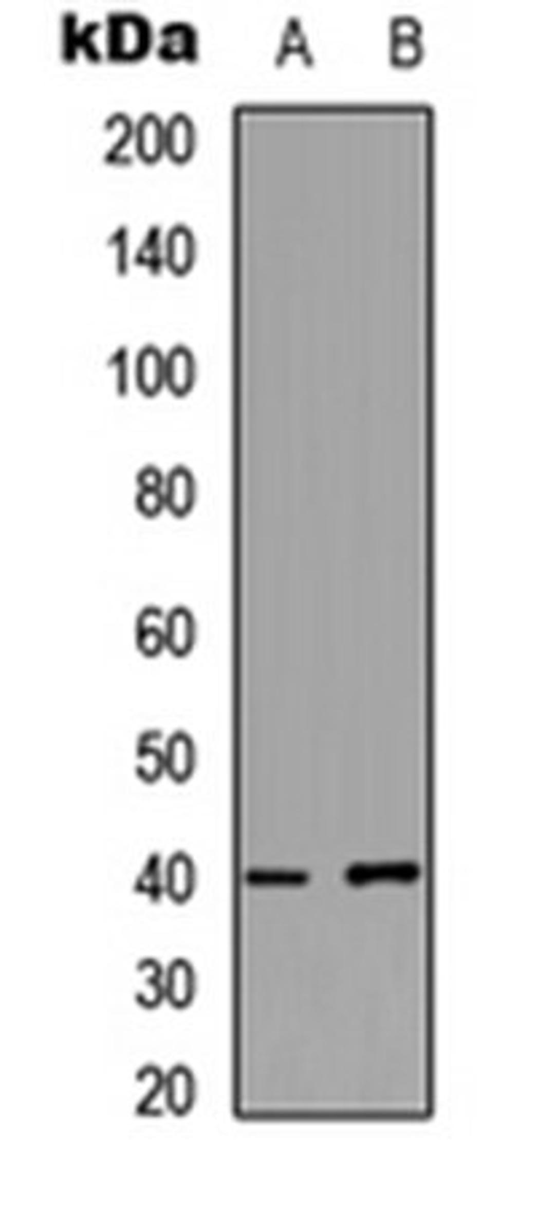 Western blot analysis of HeLa (Lane 1), MCF7 (Lane 2) whole cell lysates using PKA C gamma antibody