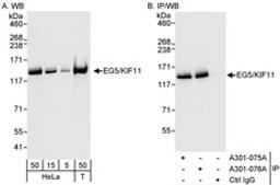 Detection of human EG5/KIF11 by western blot and immunoprecipitation.