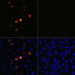 Immunofluorescence - SARS-COV-2 Spike antibody (A20022)