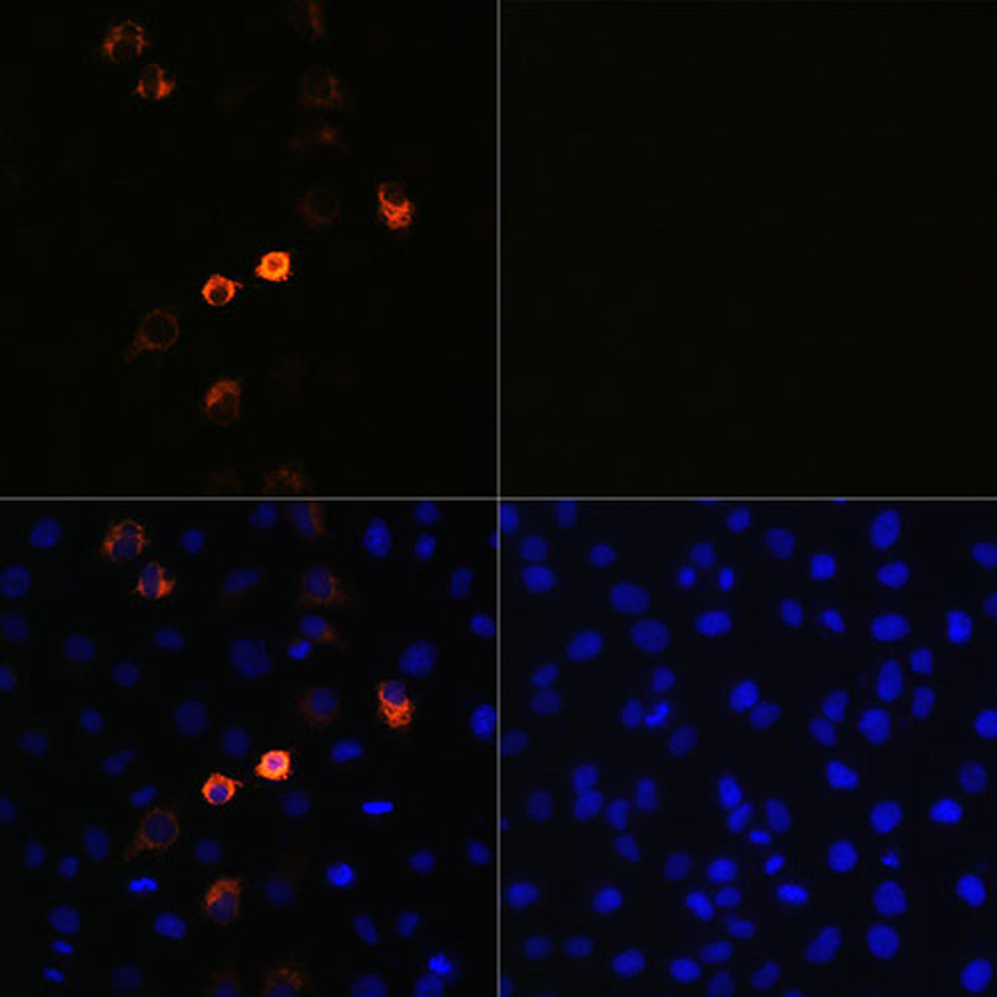 Immunofluorescence - SARS-COV-2 Spike antibody (A20022)