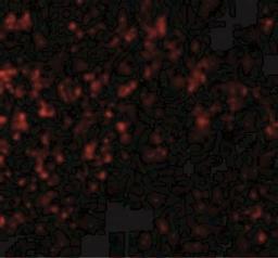 Immunocytochemistry/Immunofluorescence: GPR3 Antibody [NBP2-41102] - Immunofluorescence of GPR3 in Human Spleen cells with GPR3 antibody at 20 ug/mL.