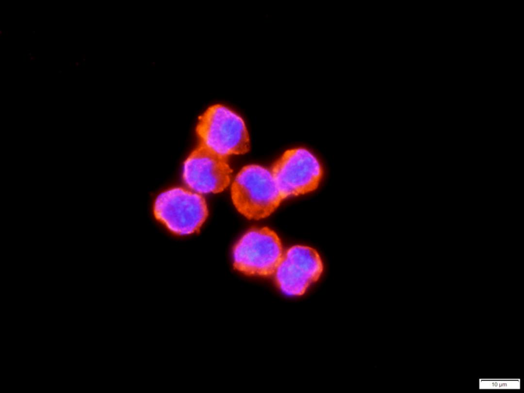 Immunofluorescence image of mouse sp20 mouse myeloma cells tissue using IL6 antibody (dilution at 1:100)