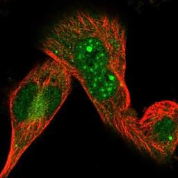 Immunocytochemistry/Immunofluorescence: LARS2 Antibody [NBP1-83059] - Immunofluorescent staining of human cell line U-251 MG shows positivity in nucleoli, nucleus but not nucleoli & cytoplasm.