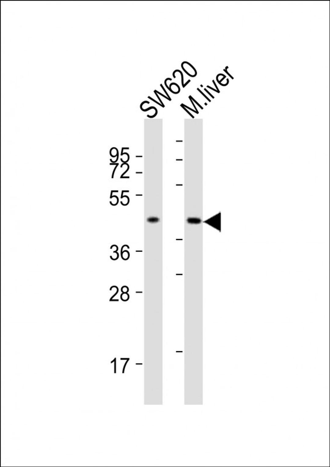 Western Blot at 1:2000 dilution Lane 1: SW620 whole cell lysates Lane 2: mouse liver lysates Lysates/proteins at 20 ug per lane.