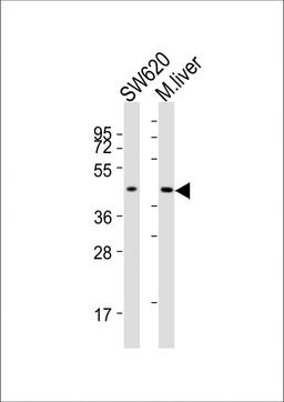 Western Blot at 1:2000 dilution Lane 1: SW620 whole cell lysates Lane 2: mouse liver lysates Lysates/proteins at 20 ug per lane.