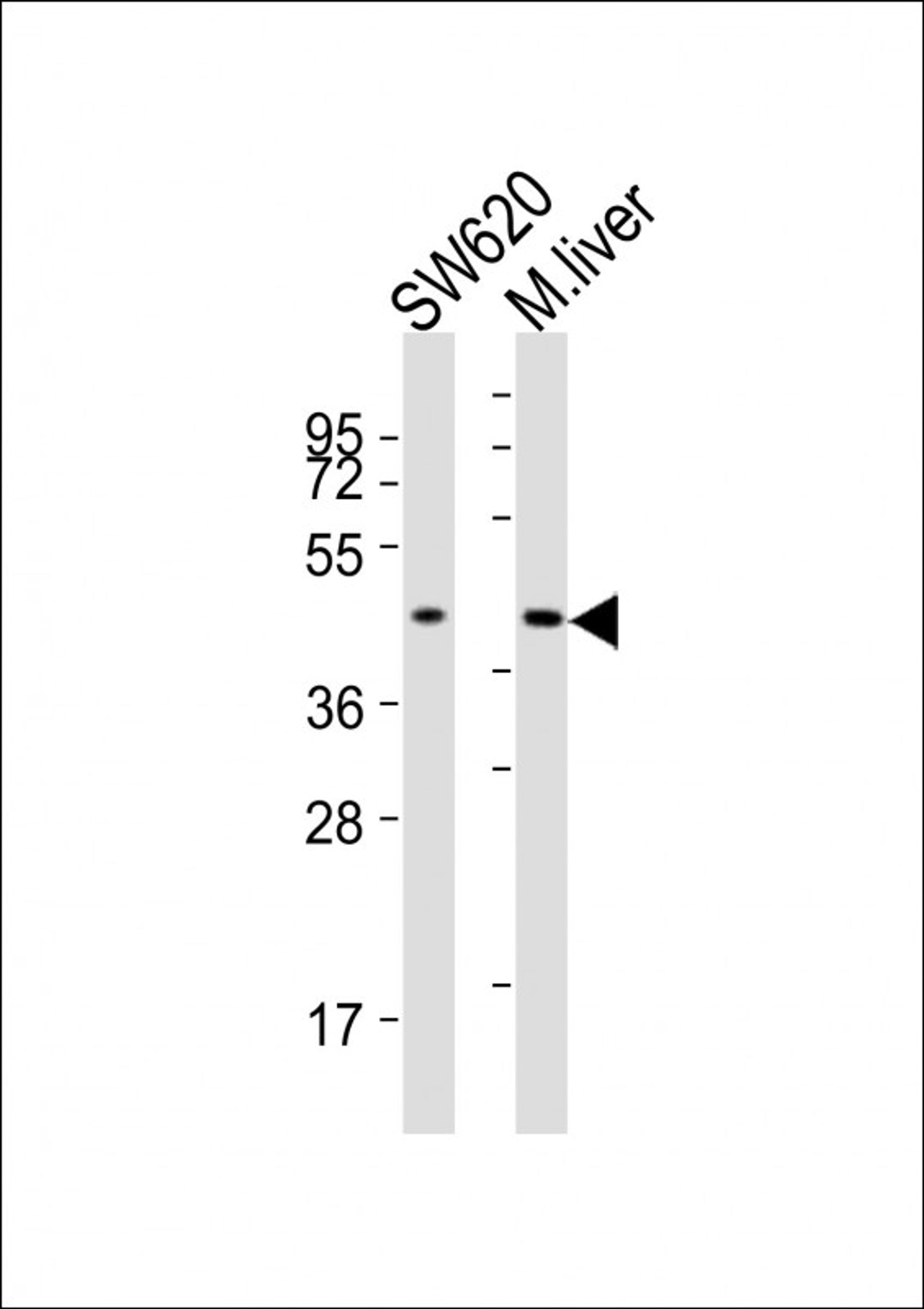 Western Blot at 1:2000 dilution Lane 1: SW620 whole cell lysates Lane 2: mouse liver lysates Lysates/proteins at 20 ug per lane.