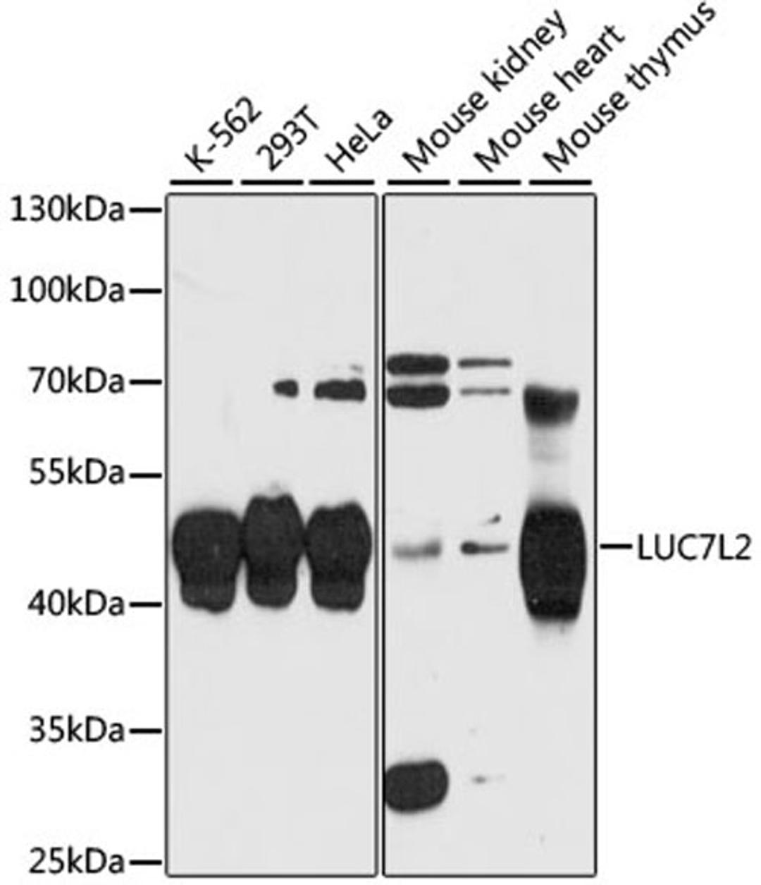 Western blot - LUC7L2 antibody (A13096)