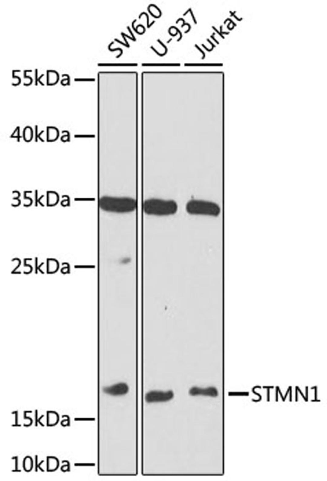 Western blot - STMN1 antibody (A14018)