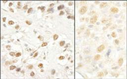 Detection of human and mouse CROP/Luc7A by immunohistochemistry.