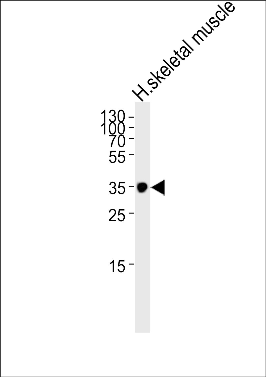 Western blot analysis of lysate from human skeletal muscle tissue lysate, using IFNGR2 Antibody at 1:1000.