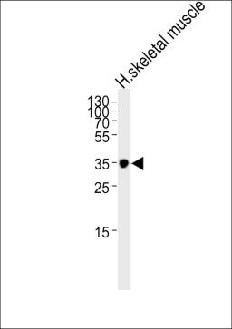 Western blot analysis of lysate from human skeletal muscle tissue lysate, using IFNGR2 Antibody at 1:1000.