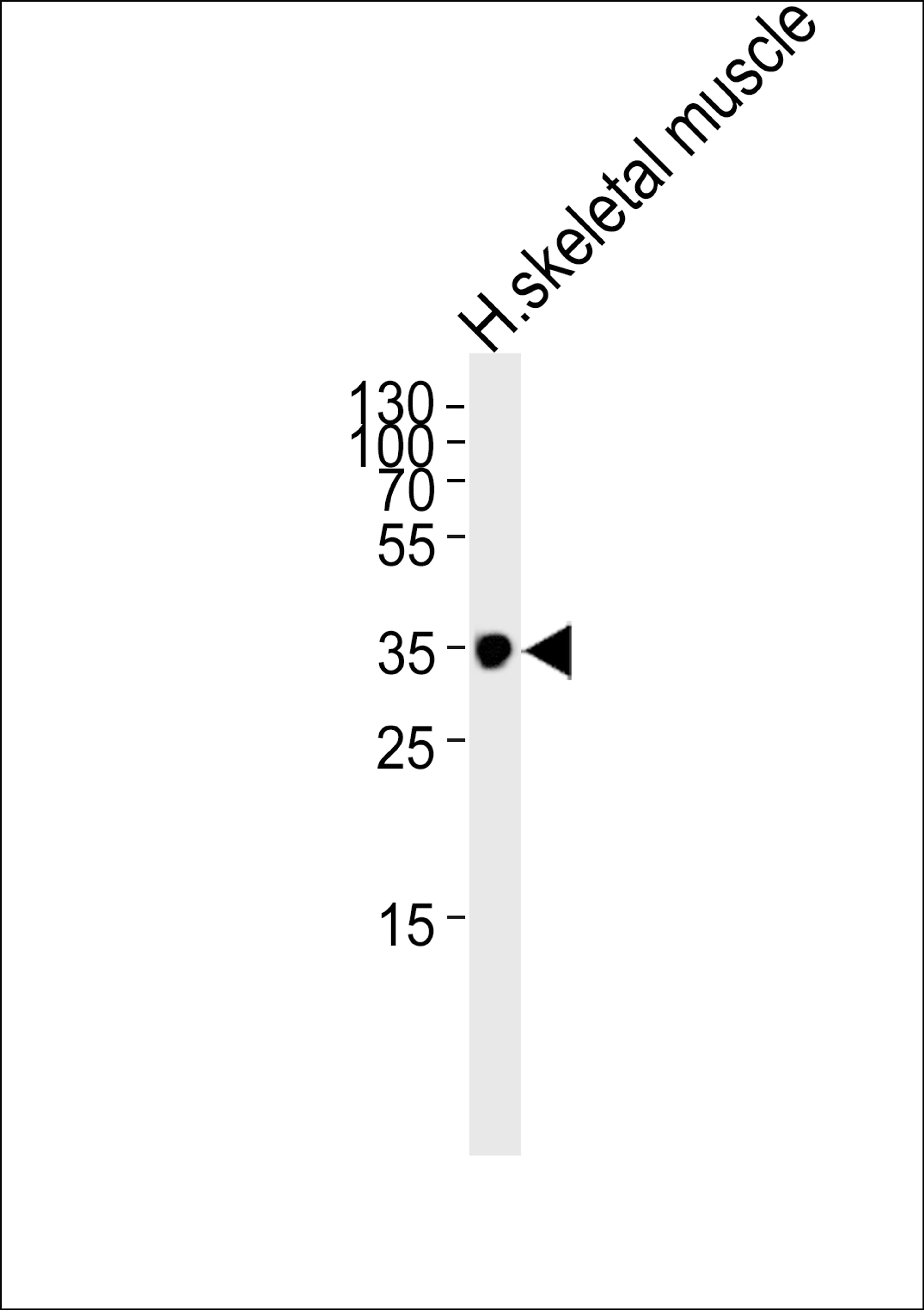 Western blot analysis of lysate from human skeletal muscle tissue lysate, using IFNGR2 Antibody at 1:1000.