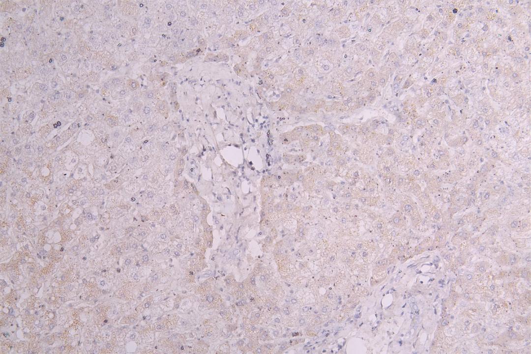 IHC image of CSB-RA003657MA1HU diluted at 1:100 and staining in paraffin-embedded human liver tissue performed on a Leica BondTM system. After dewaxing and hydration, antigen retrieval was mediated by high pressure in a citrate buffer (pH 6.0). Section was blocked with 10% normal goat serum 30min at RT. Then primary antibody (1% BSA) was incubated at 4°C overnight. The primary is detected by a Goat anti-Human IgG labeled by HRP and visualized using 0.05% DAB.