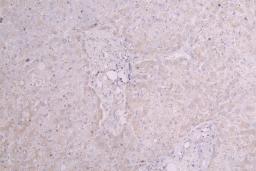 IHC image of CSB-RA003657MA1HU diluted at 1:100 and staining in paraffin-embedded human liver tissue performed on a Leica BondTM system. After dewaxing and hydration, antigen retrieval was mediated by high pressure in a citrate buffer (pH 6.0). Section was blocked with 10% normal goat serum 30min at RT. Then primary antibody (1% BSA) was incubated at 4°C overnight. The primary is detected by a Goat anti-Human IgG labeled by HRP and visualized using 0.05% DAB.