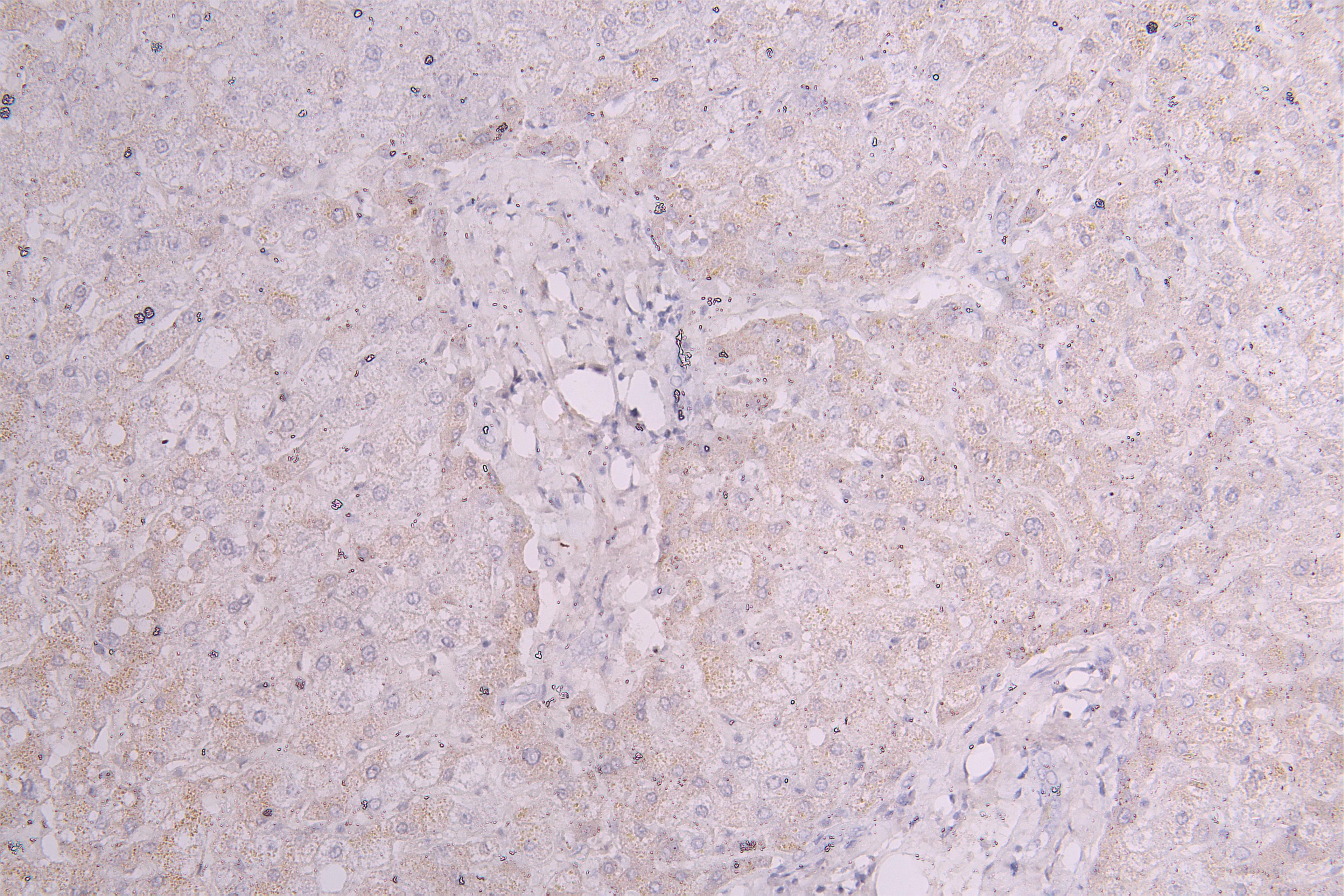 IHC image of CSB-RA003657MA1HU diluted at 1:100 and staining in paraffin-embedded human liver tissue performed on a Leica BondTM system. After dewaxing and hydration, antigen retrieval was mediated by high pressure in a citrate buffer (pH 6.0). Section was blocked with 10% normal goat serum 30min at RT. Then primary antibody (1% BSA) was incubated at 4°C overnight. The primary is detected by a Goat anti-Human IgG labeled by HRP and visualized using 0.05% DAB.
